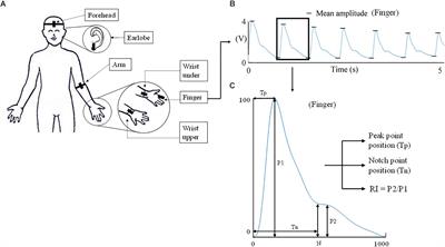 Quantitative Comparison of Photoplethysmographic Waveform Characteristics: Effect of Measurement Site